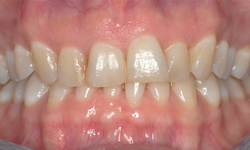 Before - NB Dental