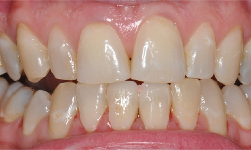 After - NB Dental