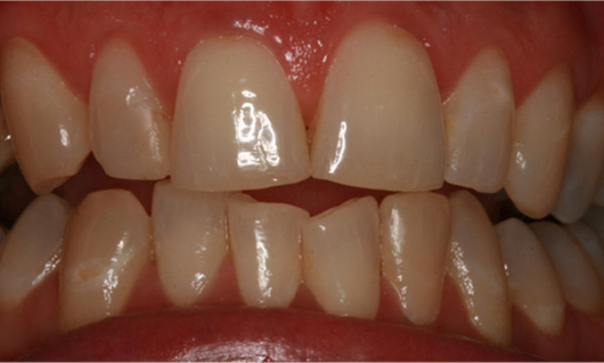 Before - NB Dental
