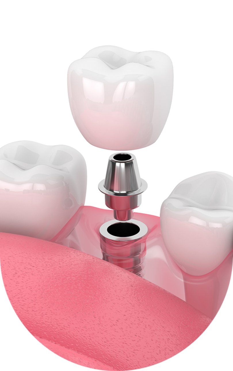 Treatment - NB Dental