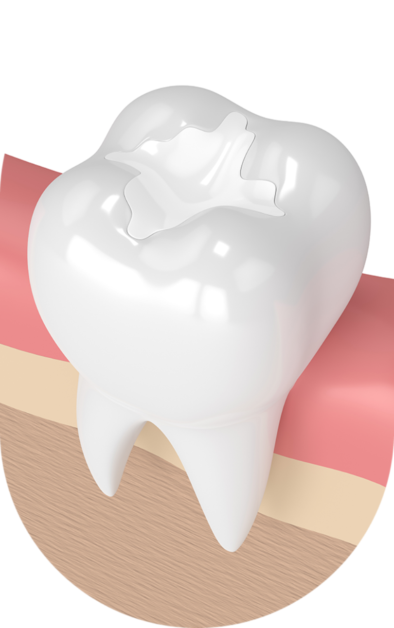 Treatment - NB Dental