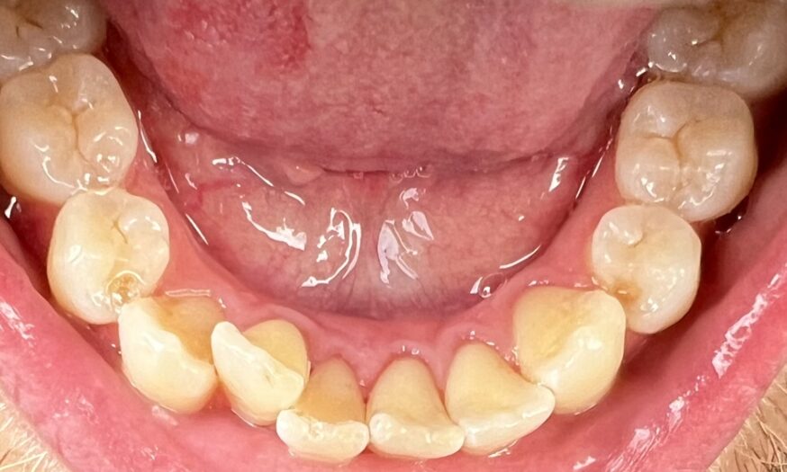 After - NB Dental