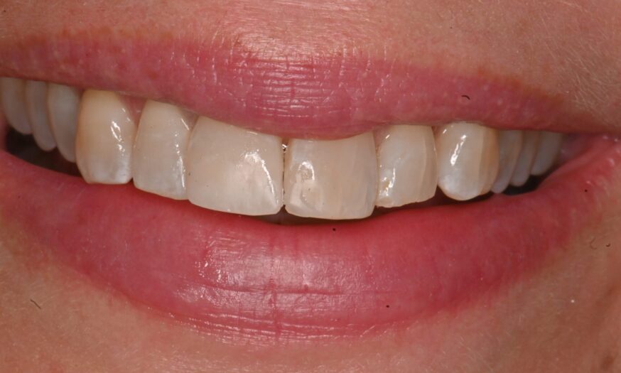 After - NB Dental