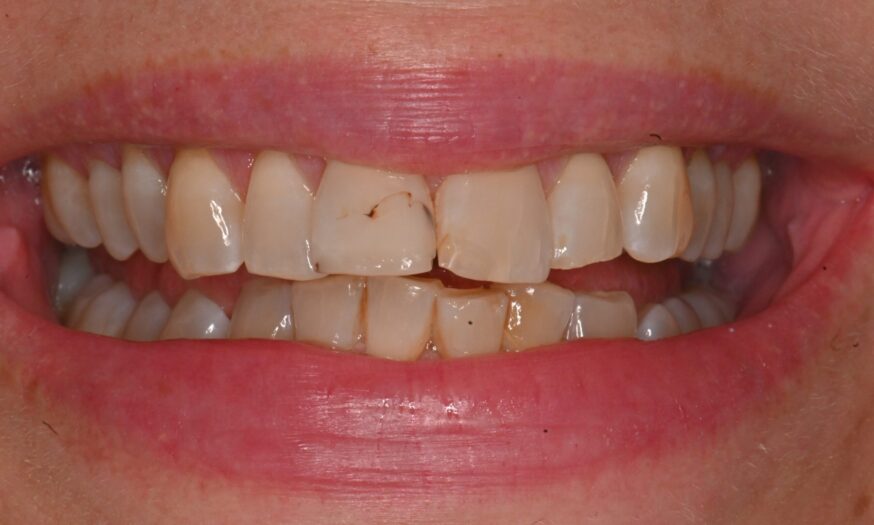 Before - NB Dental