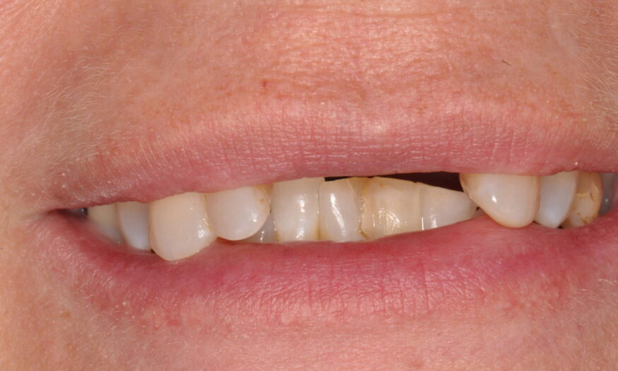 Before - NB Dental