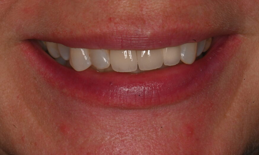 After - NB Dental