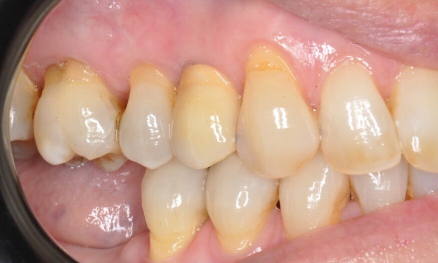 After - NB Dental