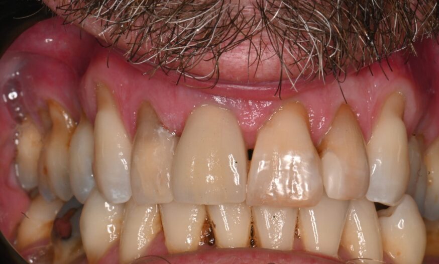 After - NB Dental