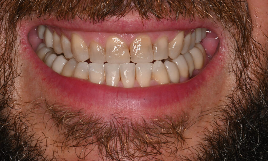 After - NB Dental