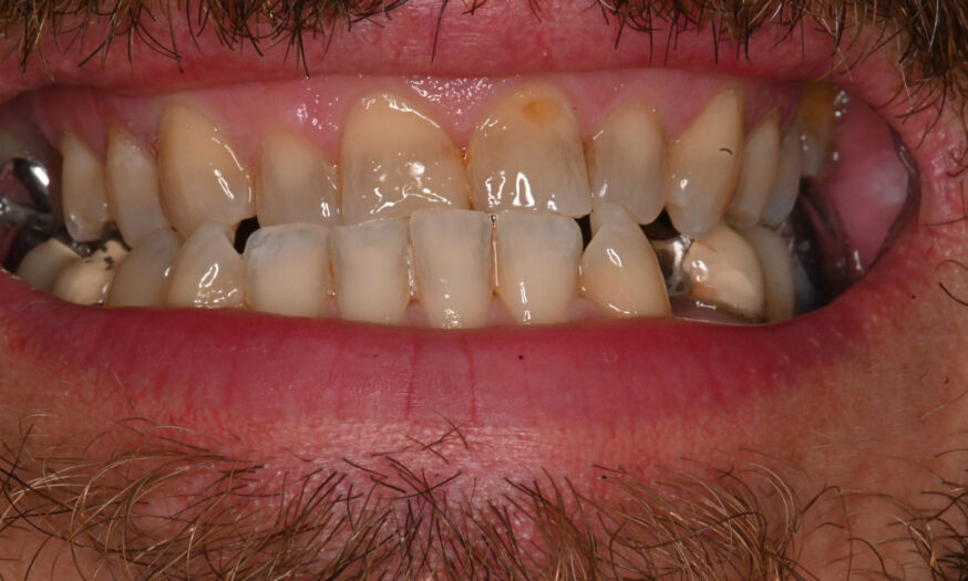 Before - NB Dental