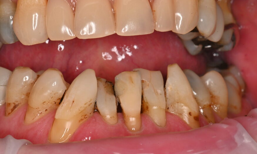Before - NB Dental