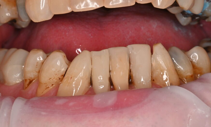 After - NB Dental
